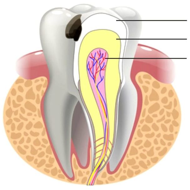 Лечение поверхностного кариеса -  Atlantis Dental