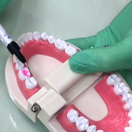 Герметизации фиссур - Atlantis Dental
